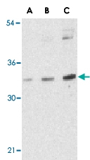 PAB12958 - BMI-1 / RNF51