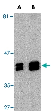 PAB12961 - Endophilin-B1