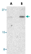 PAB12962 - BIK