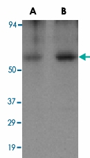 PAB12964 - Apolipoprotein J / Apo J