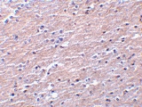 PAB12964 - Apolipoprotein J / Apo J
