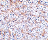 PAB12972 - CD266 / TweakR