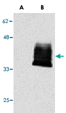 PAB12972 - CD266 / TweakR