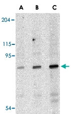 PAB12973 - DDX58