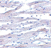 PAB12973 - DDX58