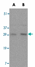 PAB12974 - CD254 / RANKL