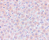 PAB12974 - CD254 / RANKL