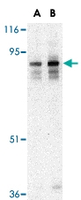 PAB12975 - LIPE