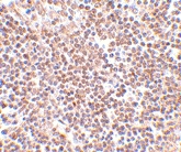 PAB12975 - LIPE