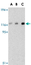 PAB12976 - CBL / RNF55