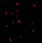 PAB12976 - CBL / RNF55