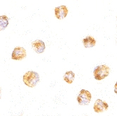 PAB12977 - SUMO1