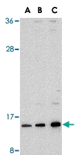 PAB12977 - SUMO1