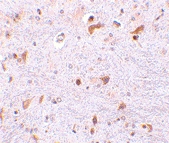 PAB12978 - PDCD4
