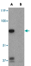 PAB12979 - STK11