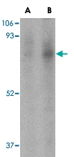 PAB12980 - FAF1