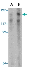 PAB12981 - TARBP1