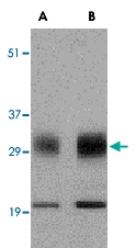 PAB12983 - SCO1 / SCOD1