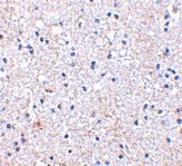 PAB12983 - SCO1 / SCOD1