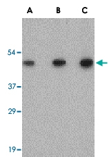 PAB12984 - SCO2