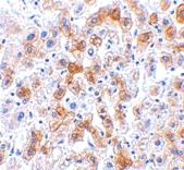 PAB12984 - SCO2