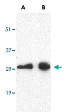 PAB12985 - CD274 / PDL1