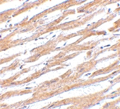 PAB12985 - CD274 / PDL1