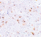 PAB12986 - CD273 / PDL2