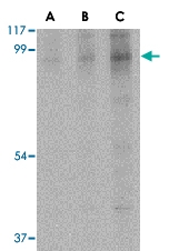 PAB12988 - BRSK2