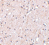 PAB12988 - BRSK2