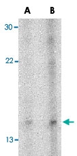 PAB12989 - Neuritin