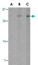 PAB12991 - ORAI2