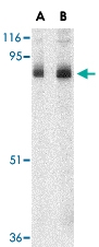PAB12992 - STIM1 / GOK