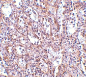 PAB12992 - STIM1 / GOK