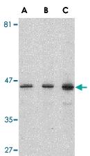 PAB12993 - Presenilin-1