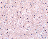 PAB12993 - Presenilin-1