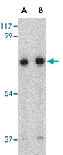 PAB12994 - HAP1