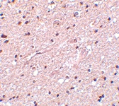PAB12994 - HAP1