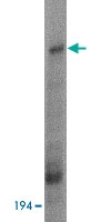 PAB12996 - HUWE1 / UREB1