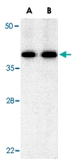 PAB12997 - BUB3
