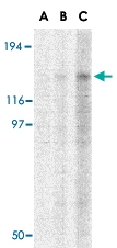 PAB12998 - TBC1D1
