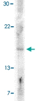 PAB12999 - IFNB / Interferon beta