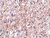 PAB12999 - IFNB / Interferon beta