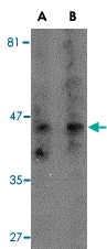 PAB13001 - Tachykinin receptor 3 (TACR3)