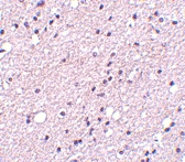 PAB13001 - Tachykinin receptor 3 (TACR3)