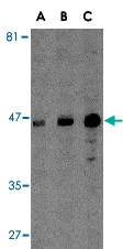 PAB13003 - MICA
