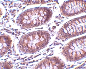 PAB13003 - MICA