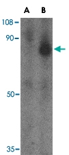 PAB13004 - Zygin-1
