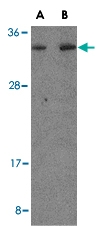 PAB13005 - MORF4