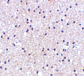 PAB13005 - MORF4
